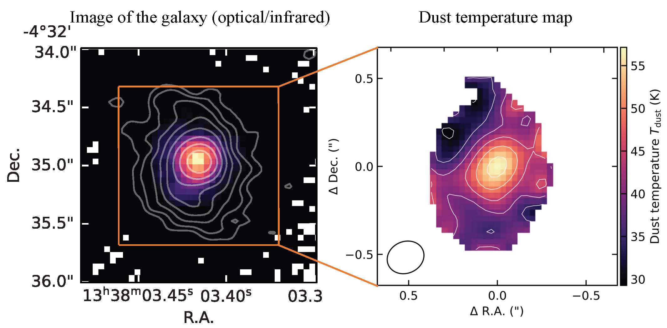 HST/ALMA image of the galaxy BRI 1335-0417 and temperature distribution